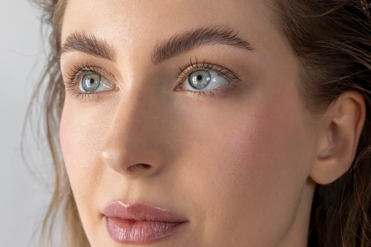 Upper Eyelid Lift